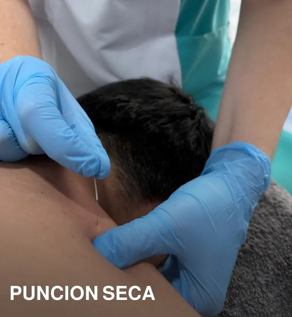 Rosa Merina Fisioterapia Avanzada puncion seca